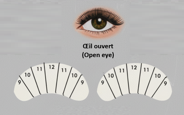 Open Eye